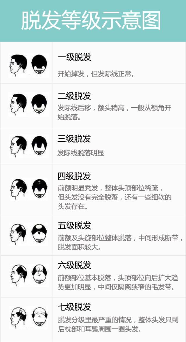 按照脱发程度,可分为7级,从1到7程度递增. 如何区分?↓ ↓对照一下吧!