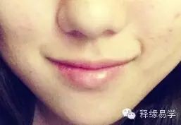 第三十三招;法令纹入口,临死不得食.