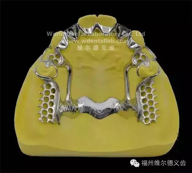bpd完美支架设计理念珍藏版bpd完美支架系统指定合作单位一览表