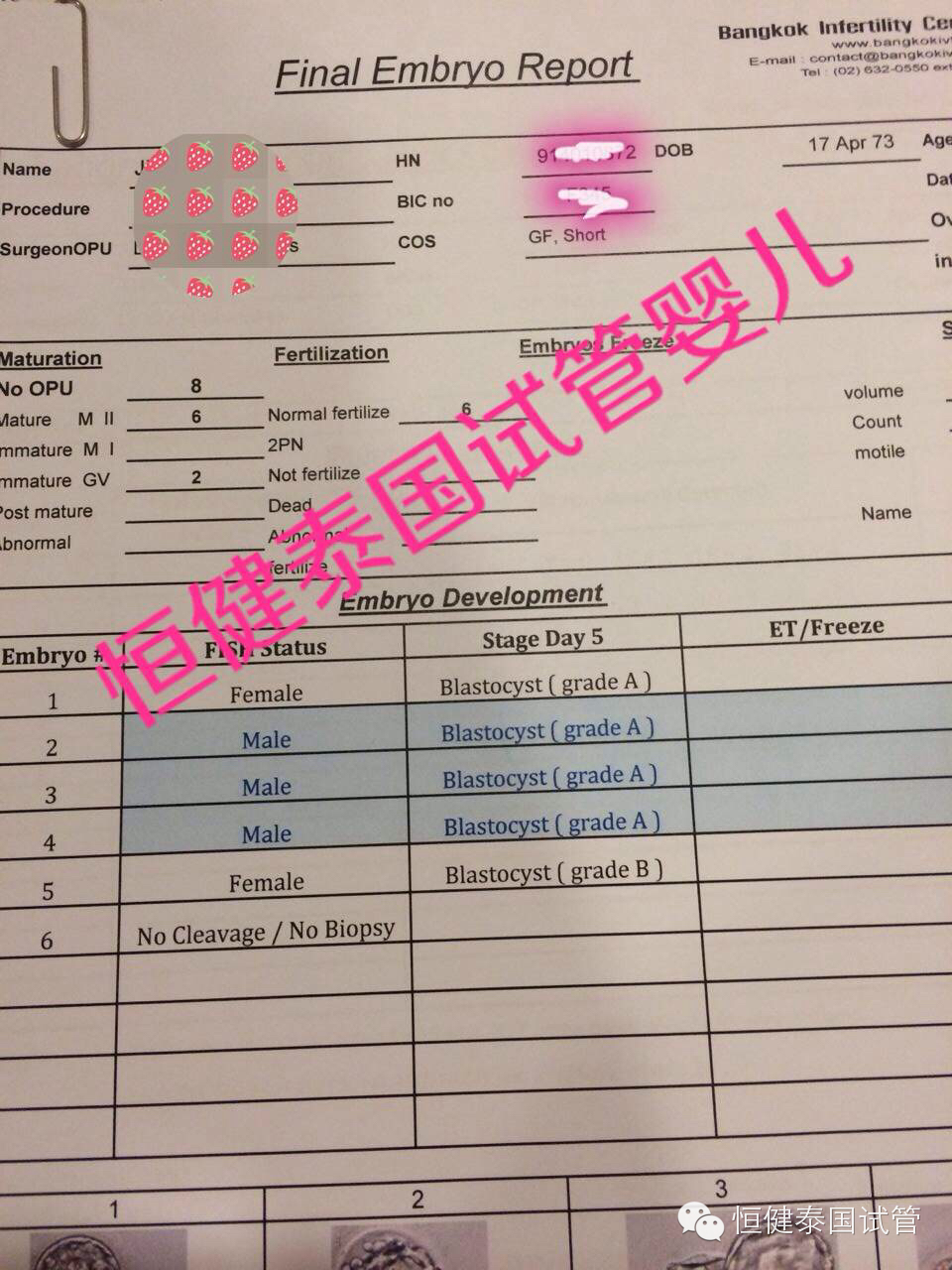 泰国试管婴儿检查报告