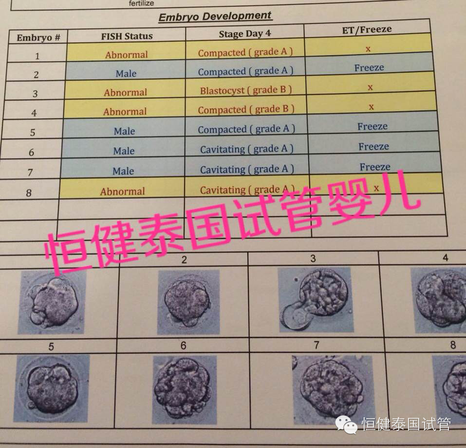 泰国试管婴儿取卵