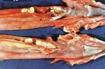 疾病多发季谨慎预防预防鸡传喉