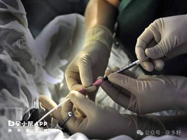 三代试管婴儿取卵后通知时间有差异，多久移植就看2种情况