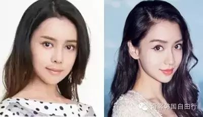 她花了100万韩国整形，从丑小鸭整到Angelababy！