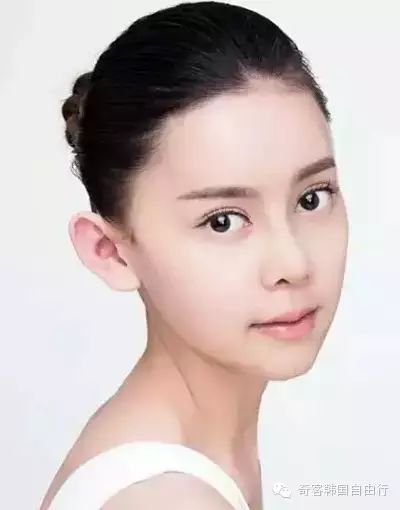 她花了100万韩国整形，从丑小鸭整到Angelababy！