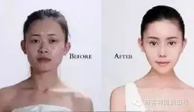 她花了100万韩国整形，从丑小鸭整到Angelababy！