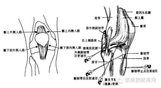 内外膝眼图片