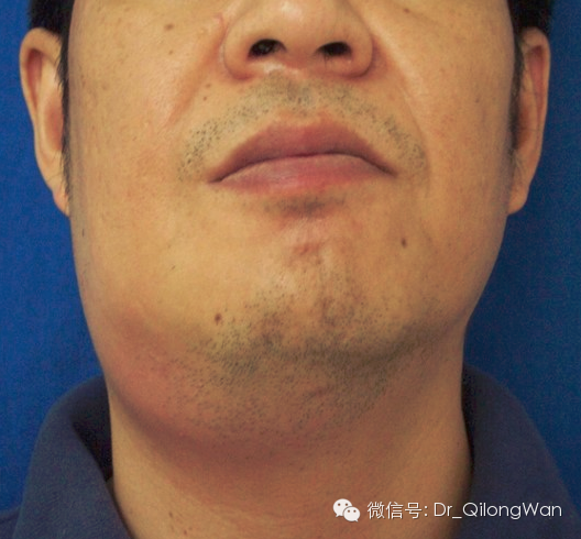 小小牙疼，何以致命？！