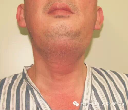 小小牙疼，何以致命？！