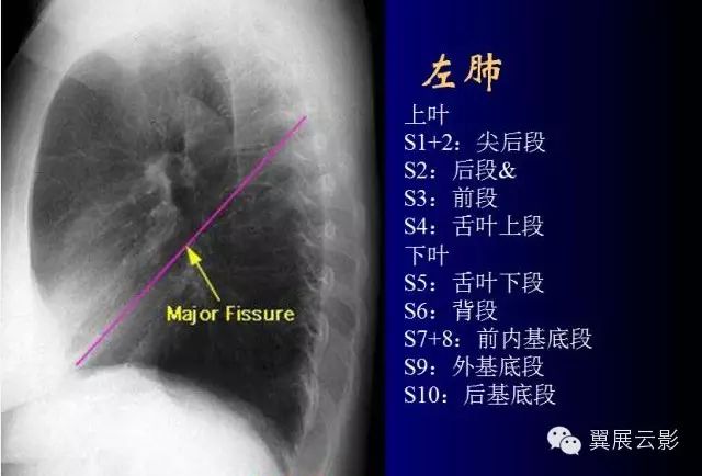 肺部基础x片及ct片解读 即时医疗