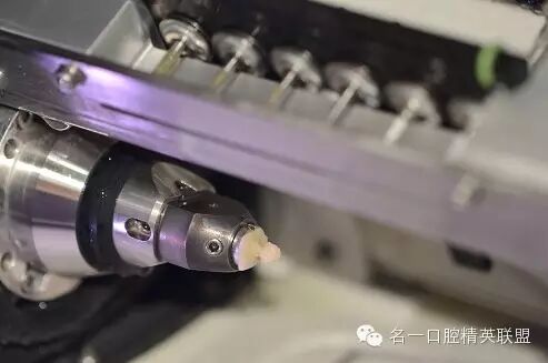 德国 KaVo 椅旁CAD/CAM系统使用流程及病例展示-名一口腔的博客-KQ88口腔博客