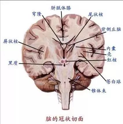 临床医学 快速学会脑出血部位辨识 即时医疗