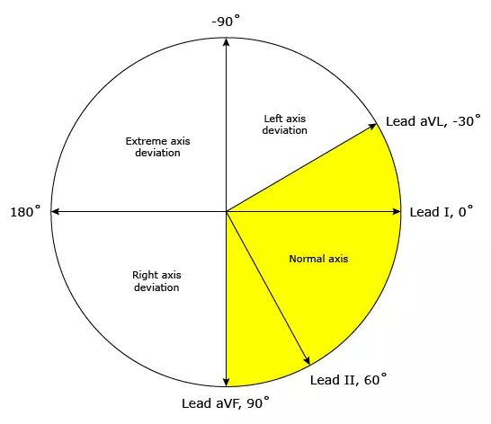 有关心电图的电轴偏移