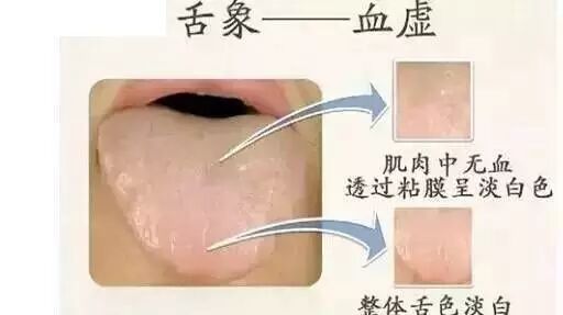 为什么医生要看你的舌头7张图教你看舌象 健康知识 泓华国际诊所 安全有效温馨便捷