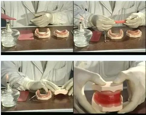 做全冠为什么要备牙肩台