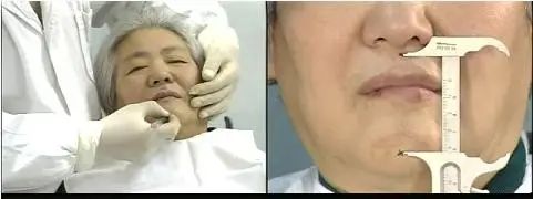 做全冠为什么要备牙肩台