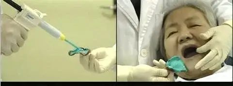 做全冠为什么要备牙肩台