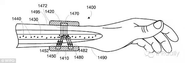 Google申请新可穿戴专利 能够杀死癌细胞