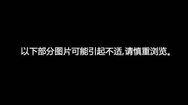 医生堕胎1000多例洗手不干 看了后你还敢堕胎吗! 医生堕胎1000多例洗手不干 看了后你还敢堕胎吗!