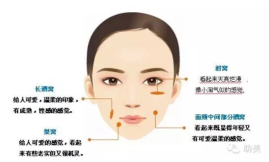 想要酒窝很简单,整形专家帮你轻松实现