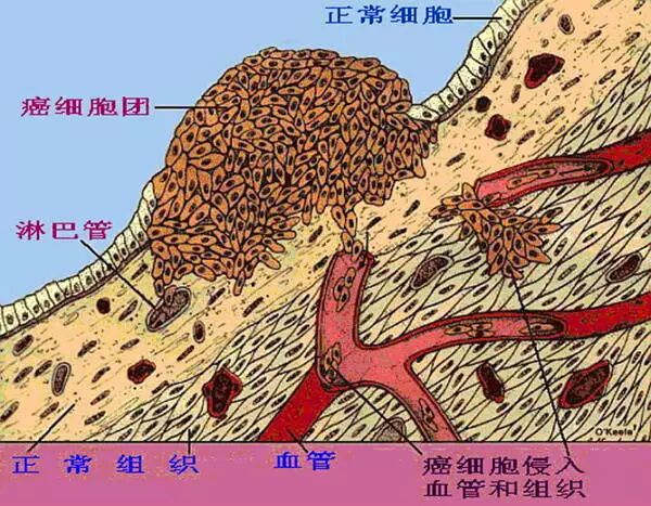 广东知名女主持人因癌症去世。癌症，再次给生命敲响警钟！！