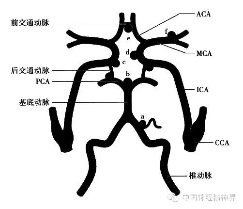 图解 脑血管病变的分布 新闻 中国神经精神界