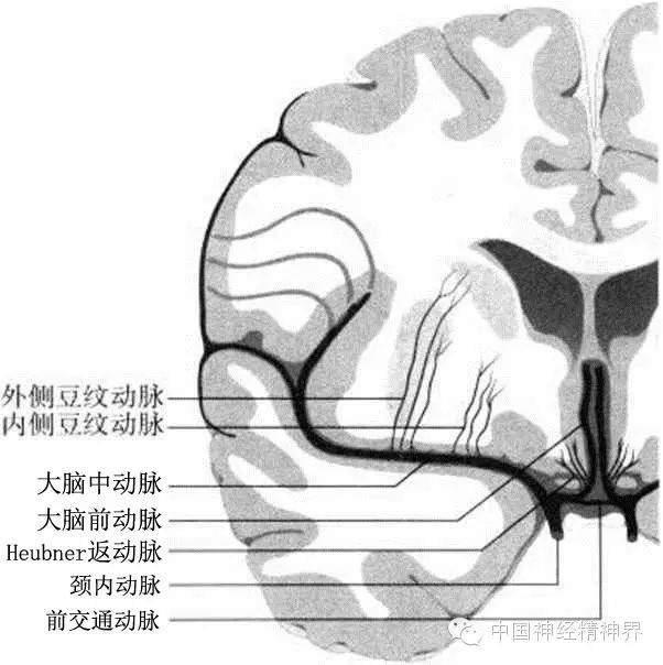 图解 脑血管病变的分布 新闻 中国神经精神界