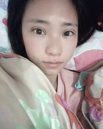 全程直播 | 全切雙眼皮，一個月變蘿莉！