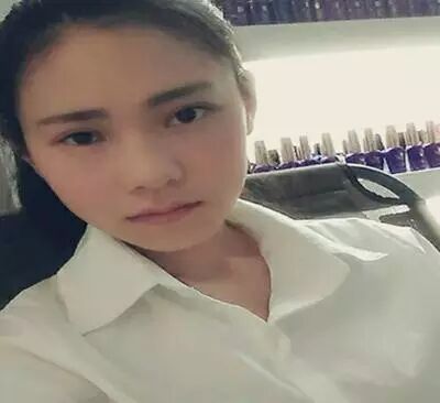 全程直播 | 全切雙眼皮，一個月變蘿莉！