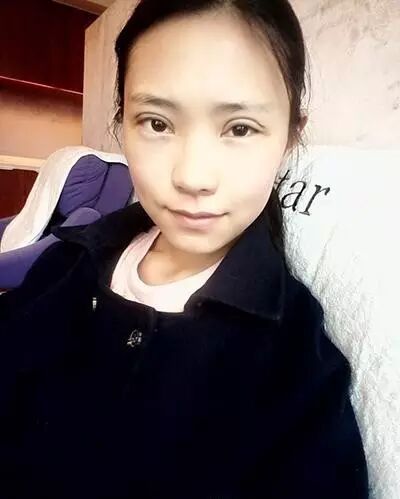 全程直播 | 全切雙眼皮，一個月變蘿莉！