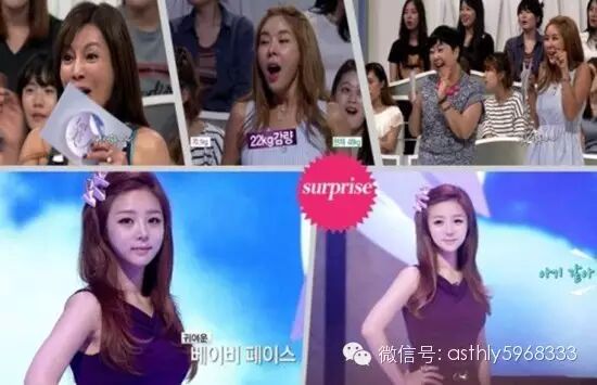 韩国面部畸形双胞胎整容逆袭成女神