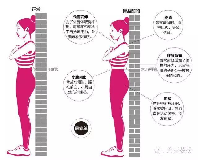 资深小腹婆必看 是不是骨盆前倾 靠墙一测便知道