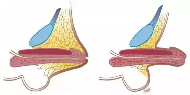 蛋蛋|【后悔】17岁大男孩的“小鸡鸡”，像两三岁孩子……这件“小事”，千万别忽视