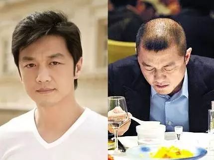 明星也躲不了脱发这把杀猪刀，“地中海”让李亚鹏变老十岁！……现在终于有办法了！