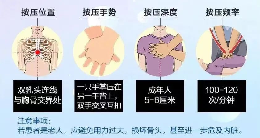 心源性猝死患者的处置措施