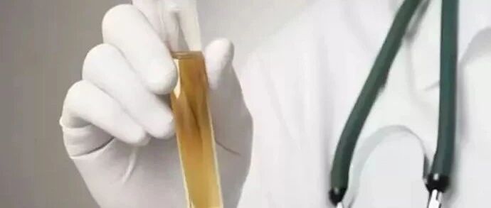 排尿很黄、异味很大？身体在向你暗示这5件事！