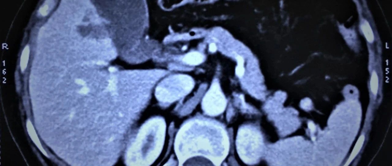 cover_image