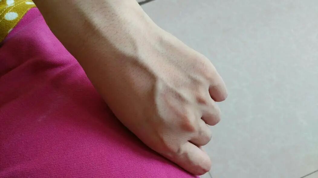 手上青筋越多，说明身体越……