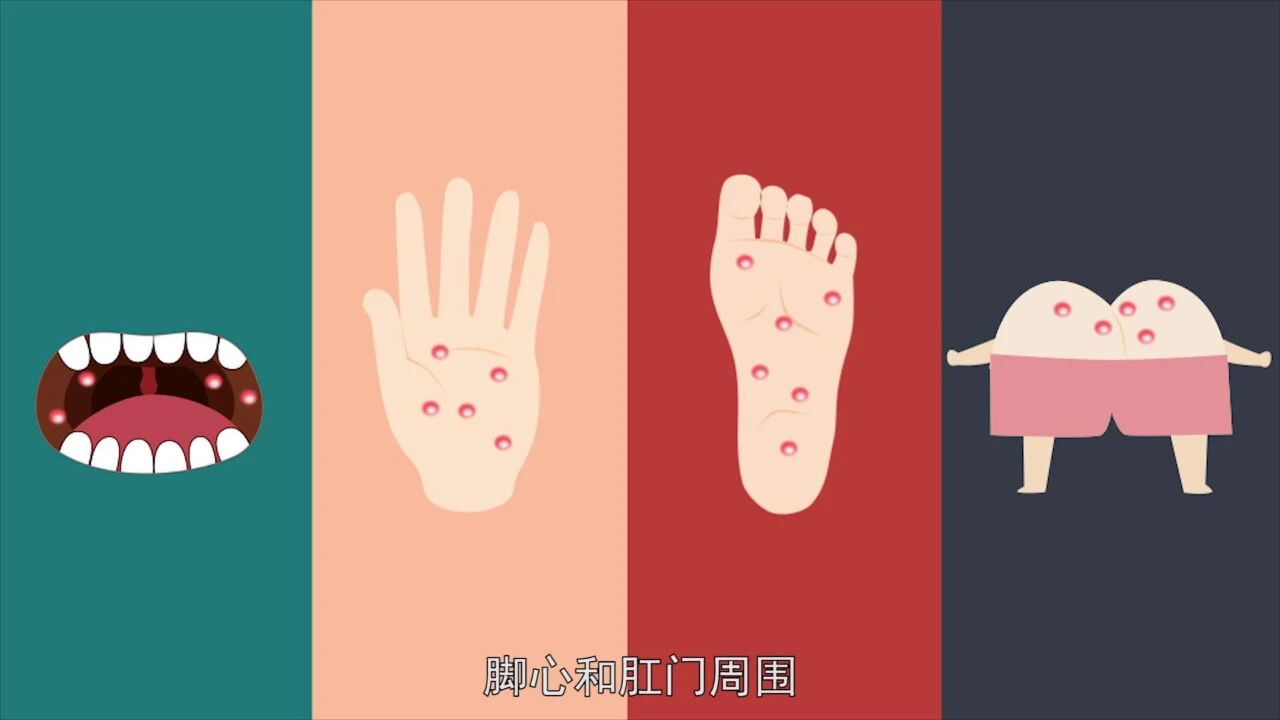 幼儿园手足口病防控工作预案（含儿歌）-幼师课件网