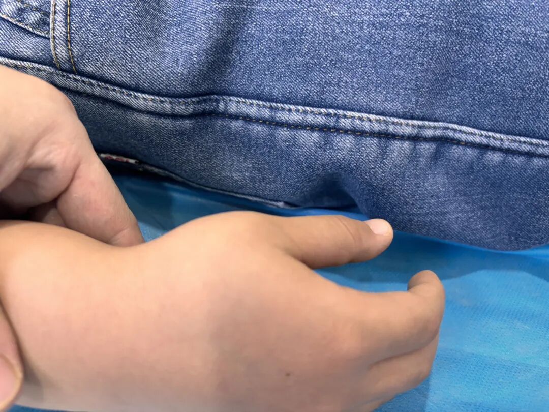 闭合复位治疗：儿童第