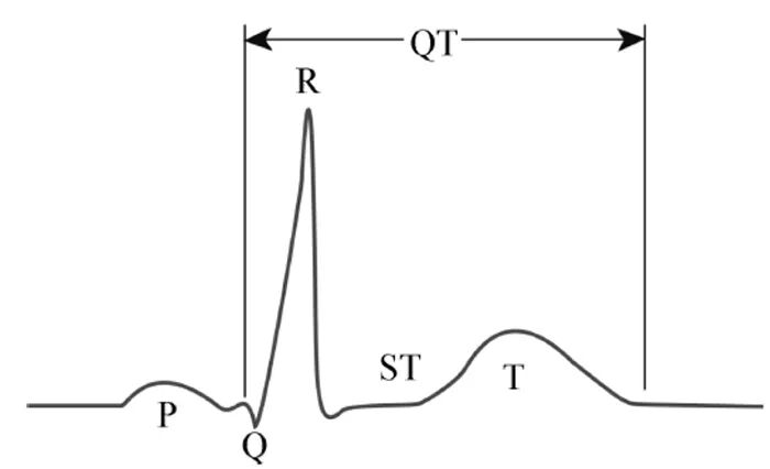 这些特征心电图改变，都是猝死的前兆