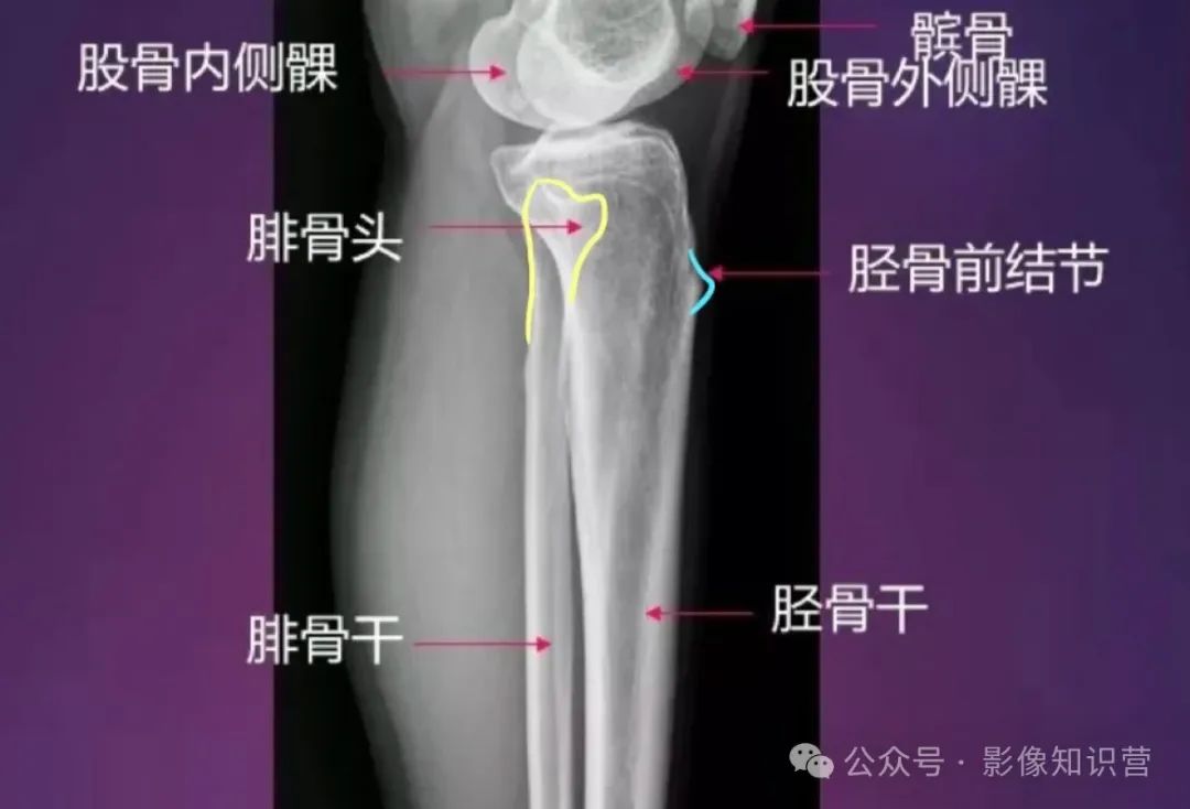 四肢骨骼影像解剖，一文掌握！