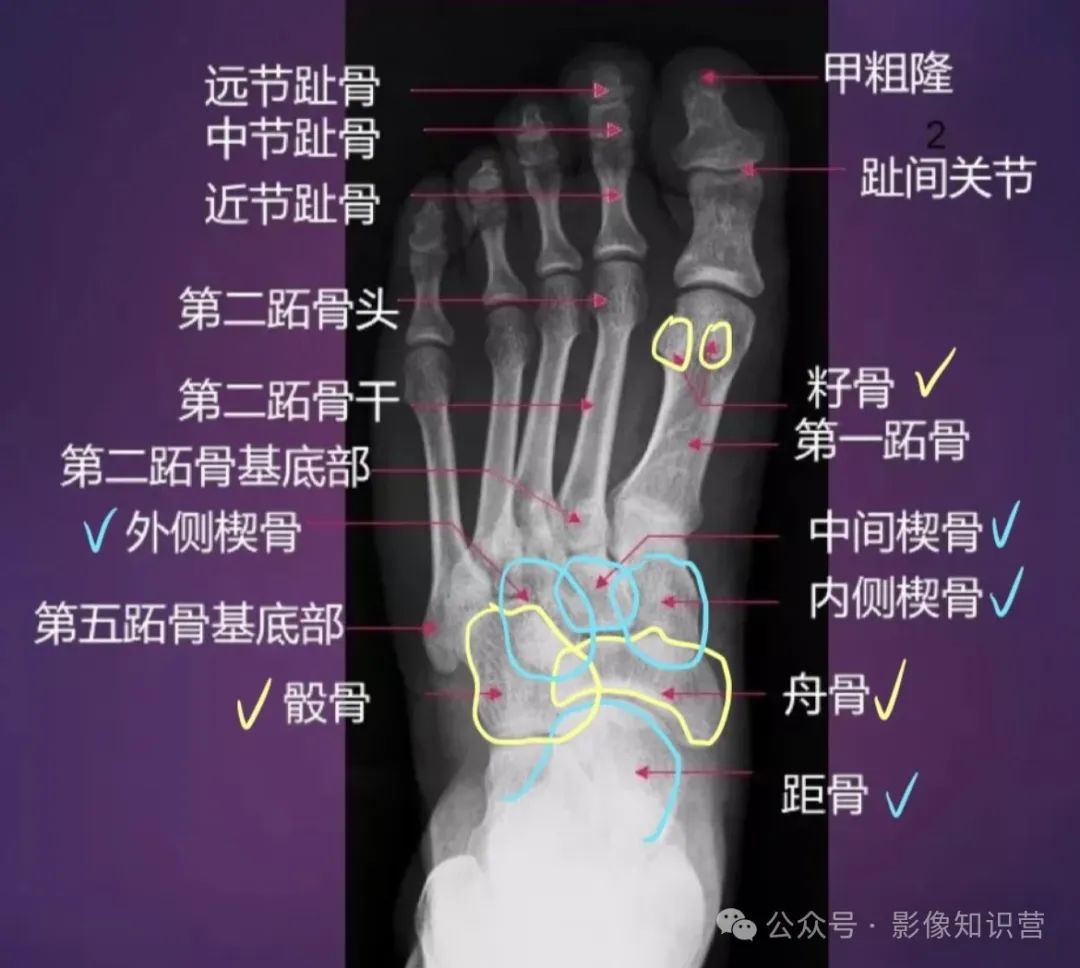 四肢骨骼影像解剖，一文掌握！