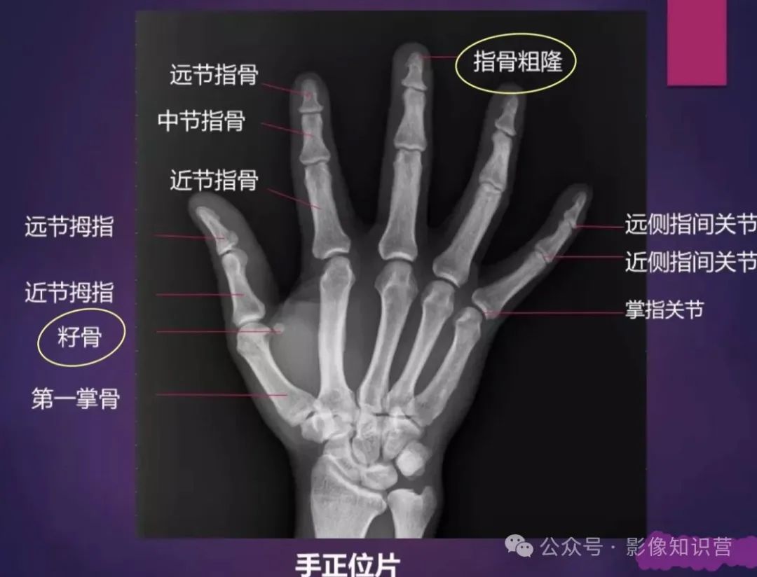 四肢骨骼影像解剖，一文掌握！
