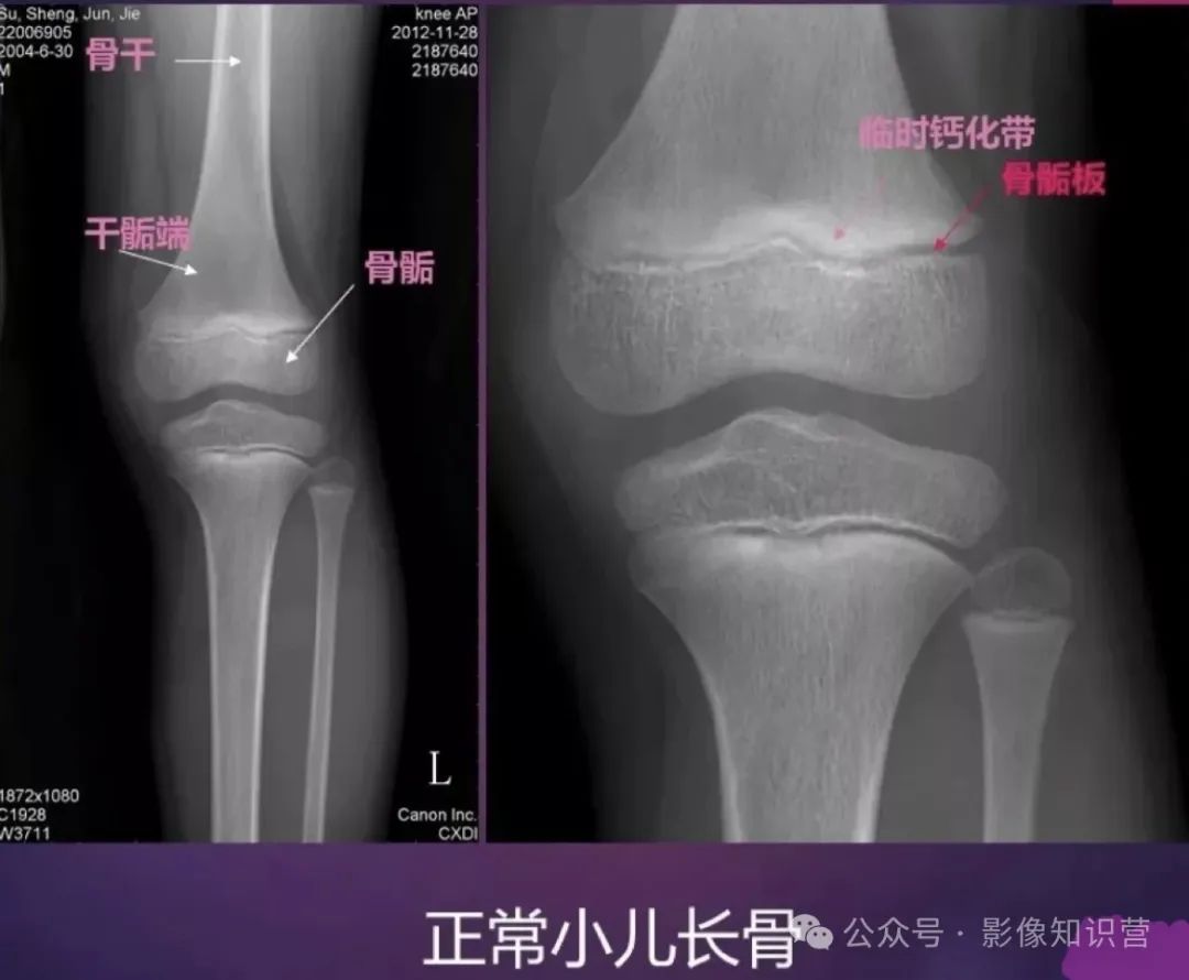 四肢骨骼影像解剖，一文掌握！