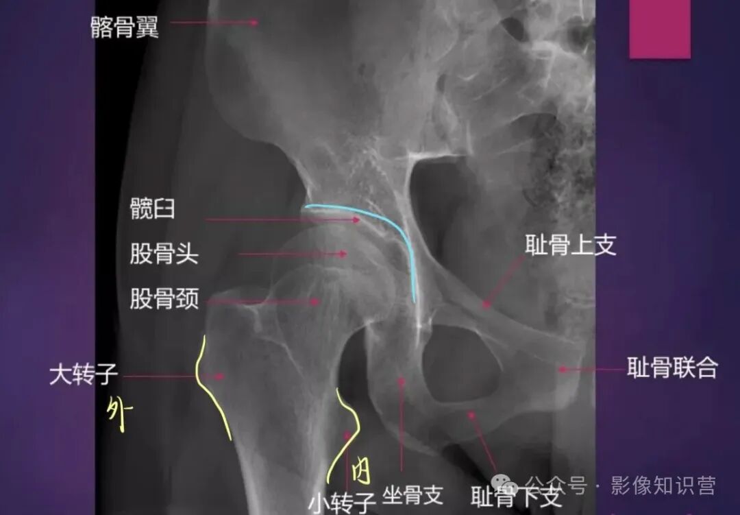 四肢骨骼影像解剖，一文掌握！