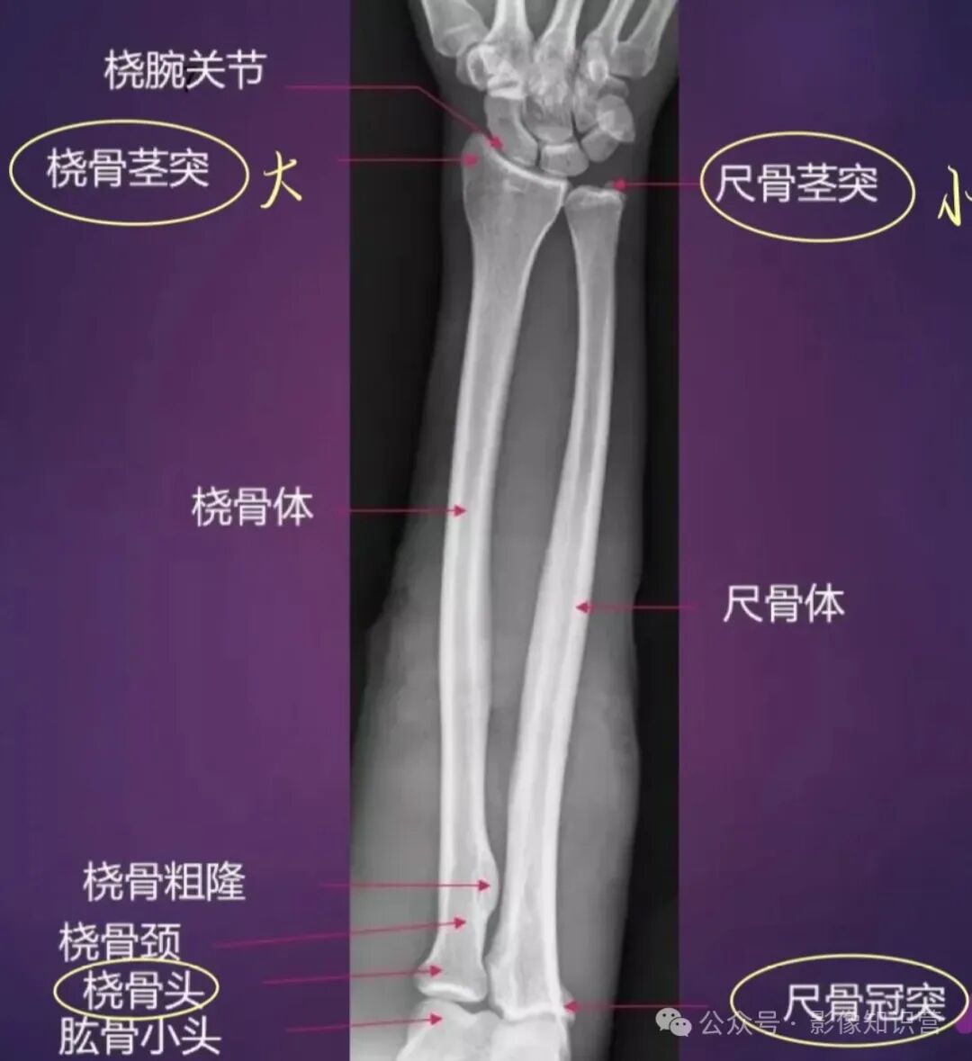 四肢骨骼影像解剖，一文掌握！