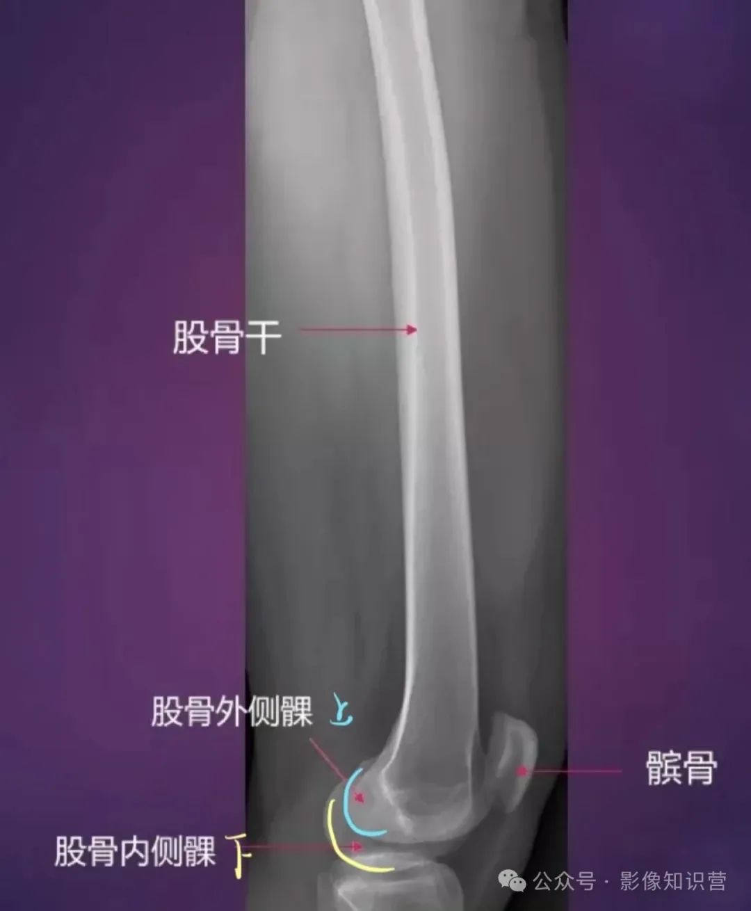 四肢骨骼影像解剖，一文掌握！