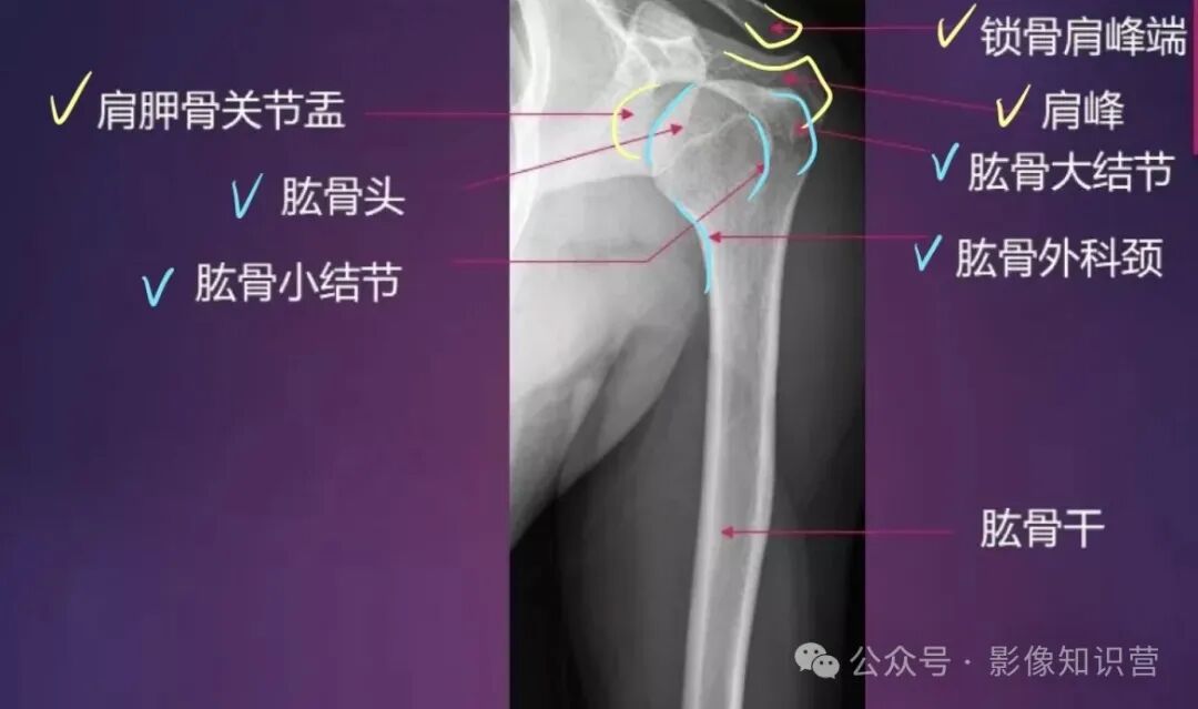 四肢骨骼影像解剖，一文掌握！