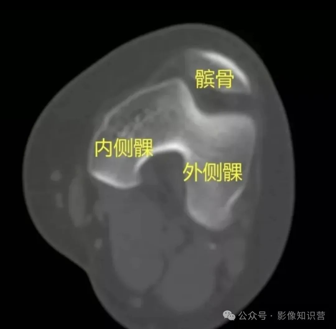 四肢骨骼影像解剖，一文掌握！